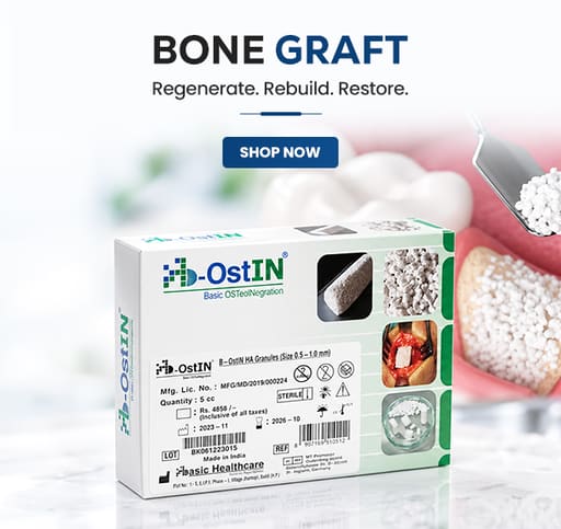 Bone Grafts