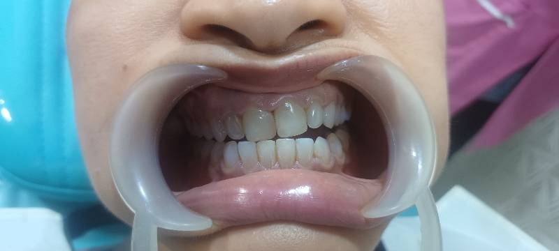 Review photo 1