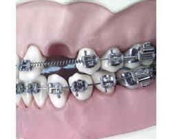 U Ortho NiTi Open Spring 0.010 Inch 180mm - 6