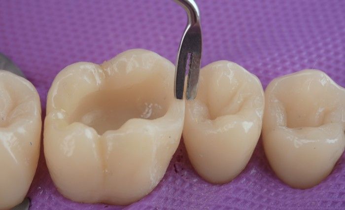 LM Arte Complete Set - 8 Restorative Instruments With Cassette