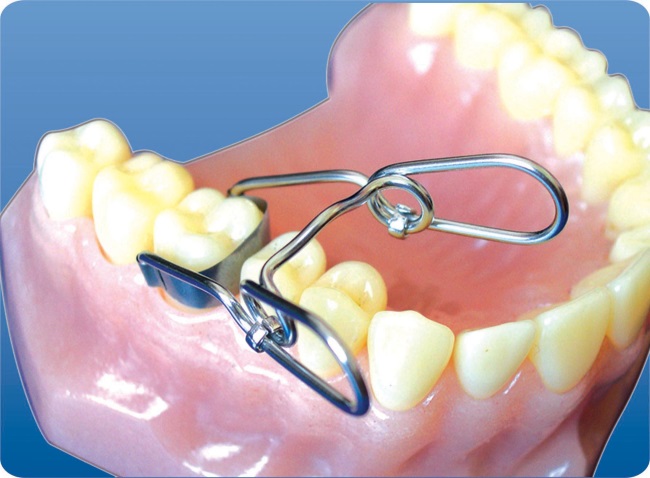 Tor Vm Saddle Contoured Metal Matrices