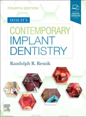 Misch's Contemporary Implant Dentistry 4th Edition (ISBN - 391559)