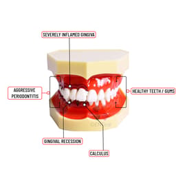 iDENTical Periodontal Disease Model M4025 - 4