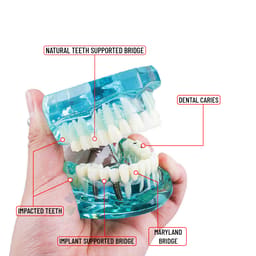 iDENTical All In One Implant Models M2001 - 12