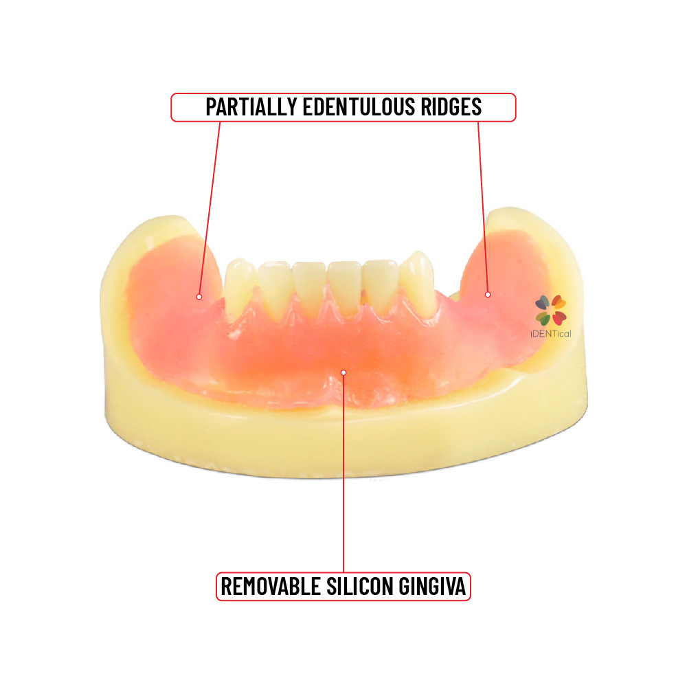 iDENTical Dental Implant Practicing Model Mandible M2009