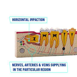 iDENTical Third molar Impaction Teeth Model M4009 - 7