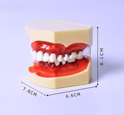 iDENTical Periodontal Disease Model M4025 - 6