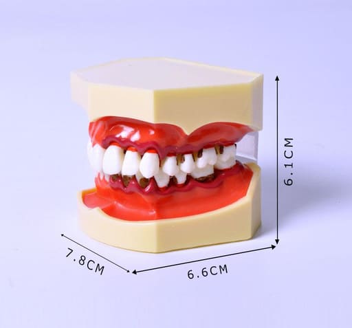 iDENTical Periodontal Disease Model M4025
