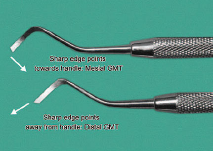 Dental GMT (Gingival Margin Trimmer)