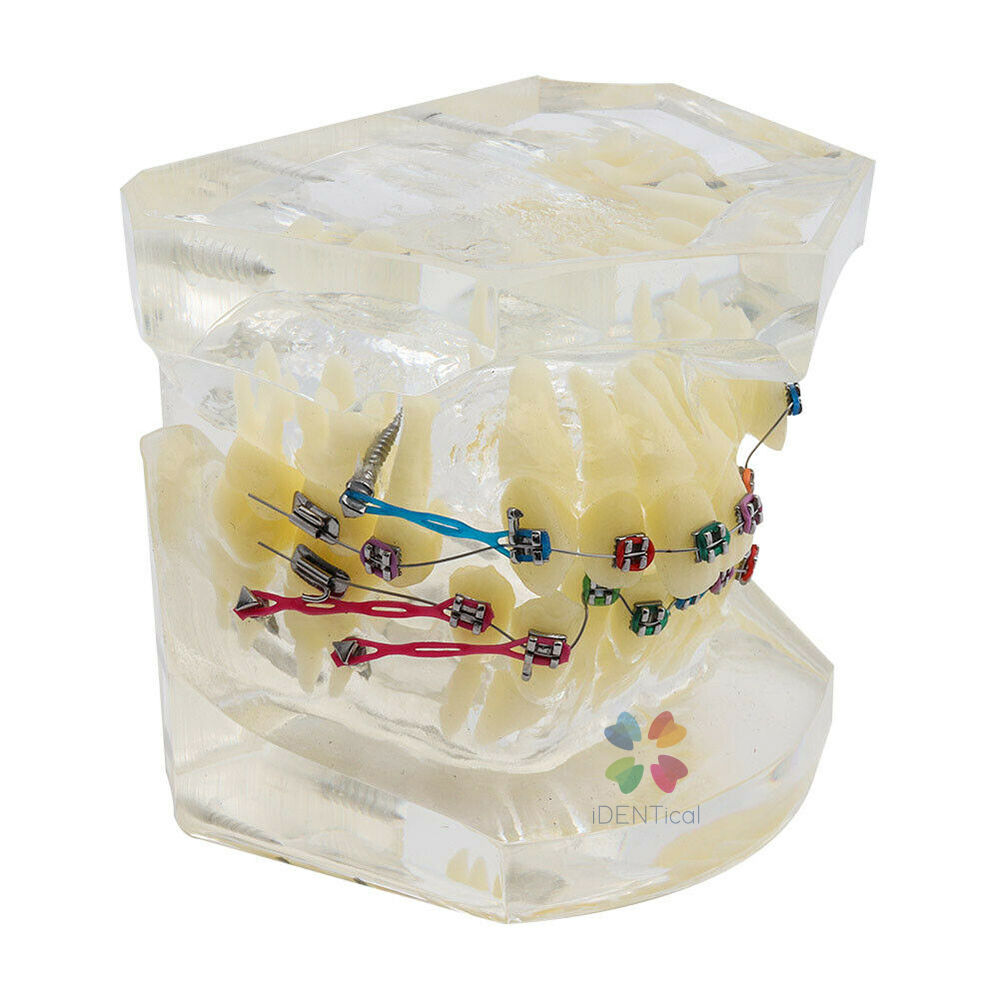 iDENTical Dental Orthodontic Model M3005-3