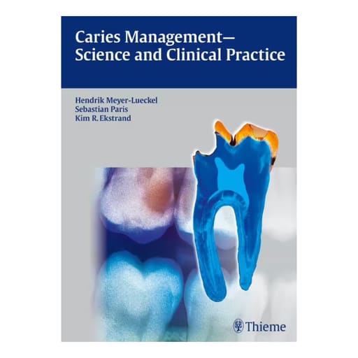 Caries Management - Science And Clinical Practice (ISBN - 547118)