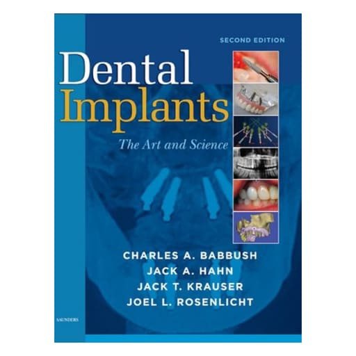 Dental Implants: The Art And Science (ISBN - 053415)