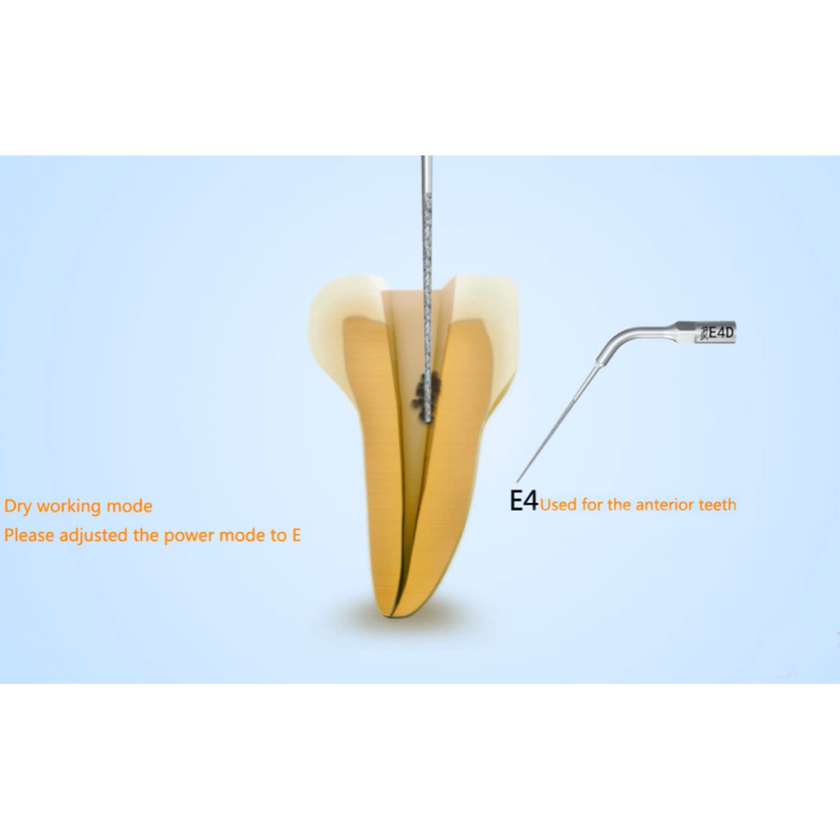 Woodpecker Scaler Tip E4D for UDS & EMS Scalers