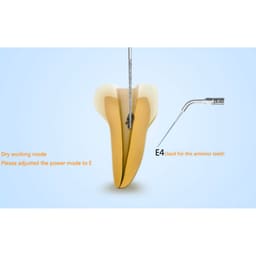 Woodpecker Scaler Tip E4D for UDS & EMS Scalers - 6