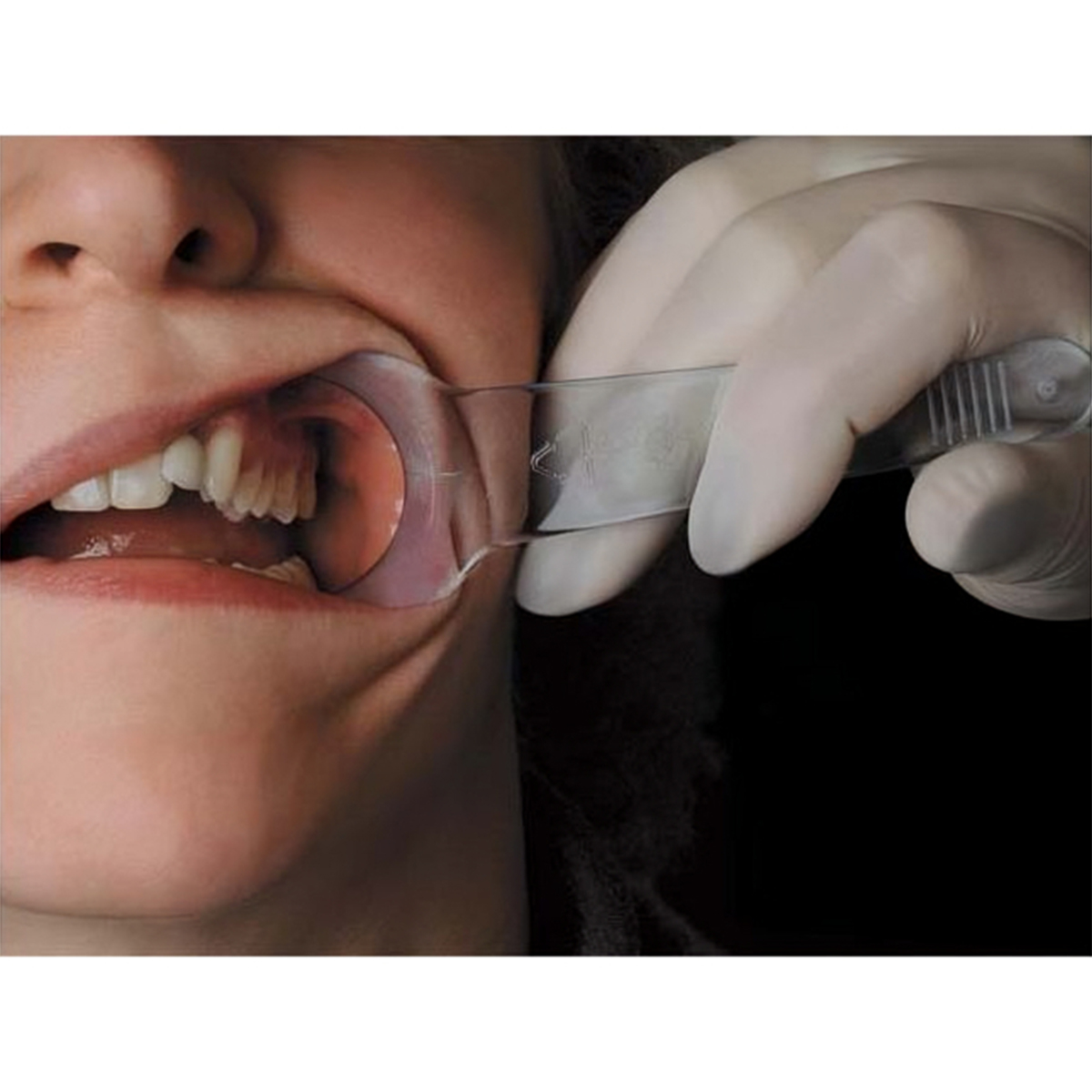 Cotisen Cheek Retractor Y Type- Small Pk/2