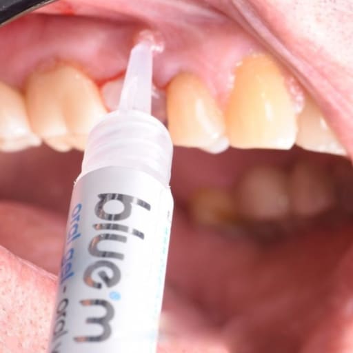 BlueM Oral Gels