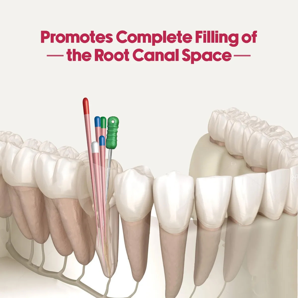 Waldent Finger Spreaders 21mm # 15-40 (Pack of 6)