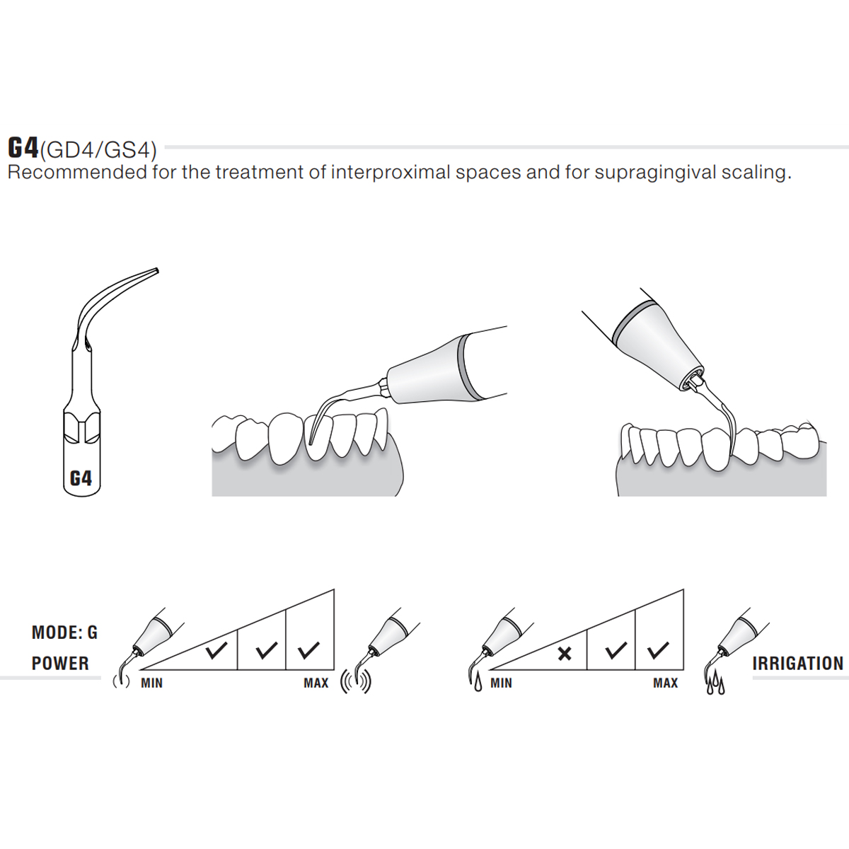 Woodpecker Scaler Tip G4 for UDS & EMS Scalers