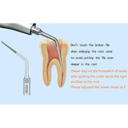 Woodpecker Scaler Tip ED3D for DTE & Satelec Scalers - 6