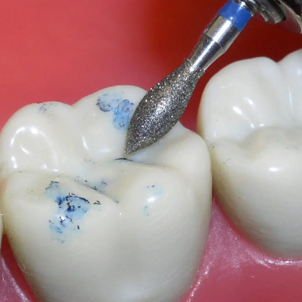 Pivo Best All - Round Airotor Burs Kit (Set Of 15)