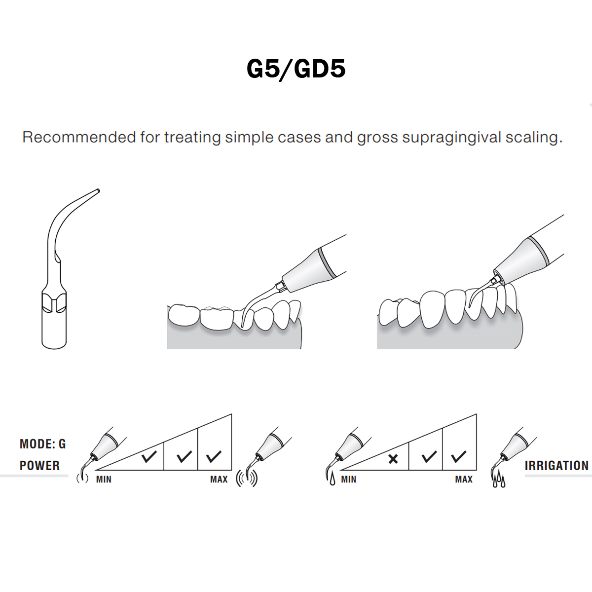 Woodpecker Scaler Tip GD5 for DTE & Satelec Scalers