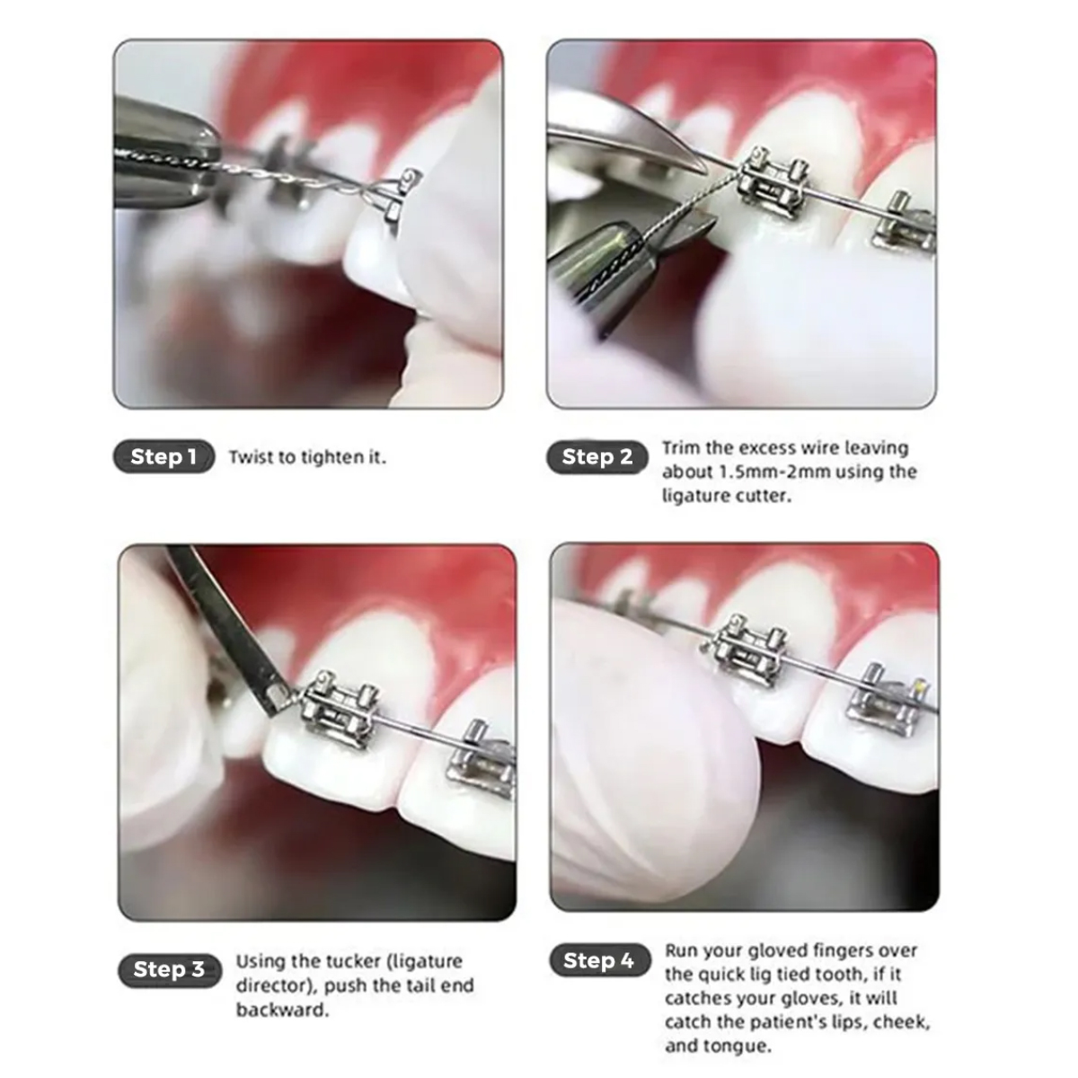 U Ortho SS Ligature Wires 50g Spool - 0.20mm