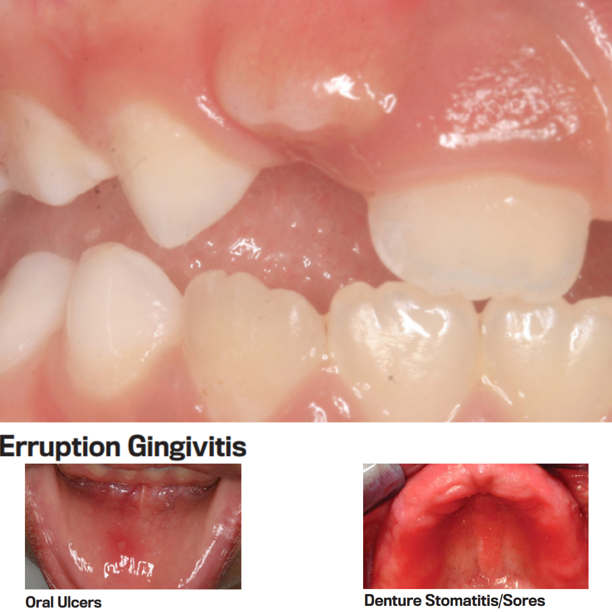 Sandika Pharma Gee - X Pain Relieving Gel (Pack of 10)