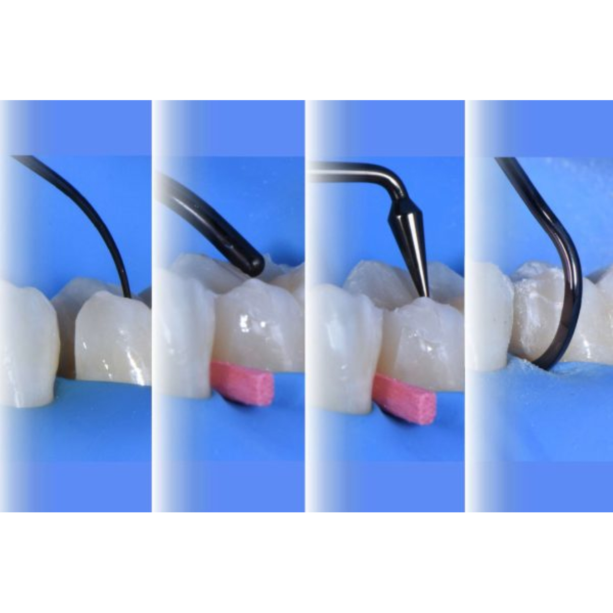 LM-Arte Composite Filling Instruments