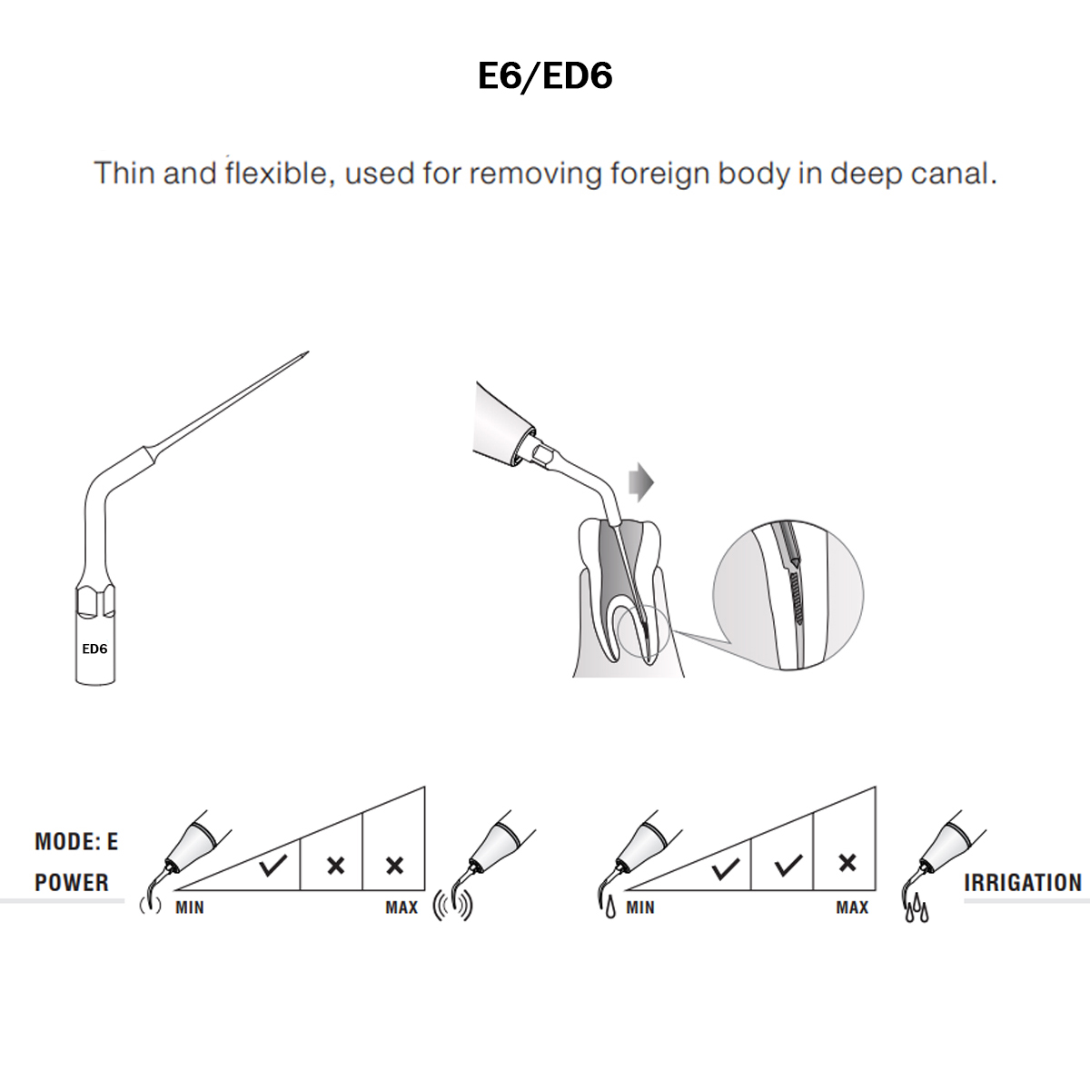 Woodpecker Scaler Tip ED6 for DTE & Satelec Scalers