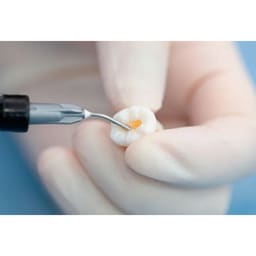 DPI Curex Flow Lightcure Flowable Restorative Composite Refills - 4