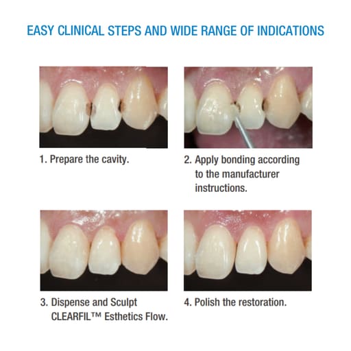 Kuraray Clearfil AP-X Esthetic Flow Flowable Composite Refills