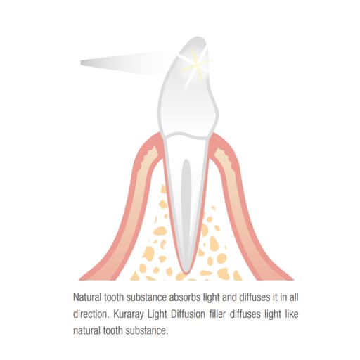 Kuraray Clearfil AP-X Esthetic Flow Flowable Composite Refills