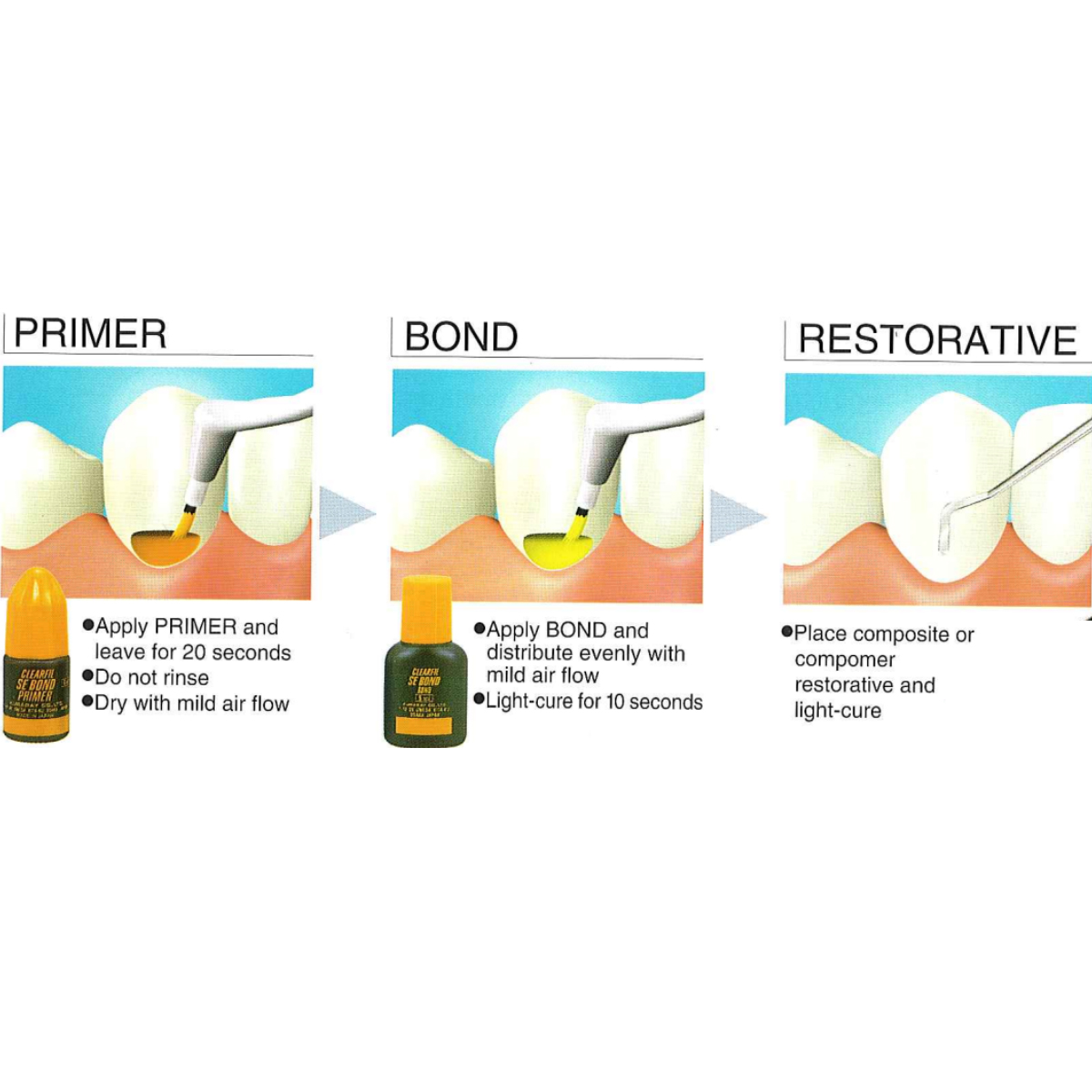 Kuraray Clearfil SE Bond Introductory Kit
