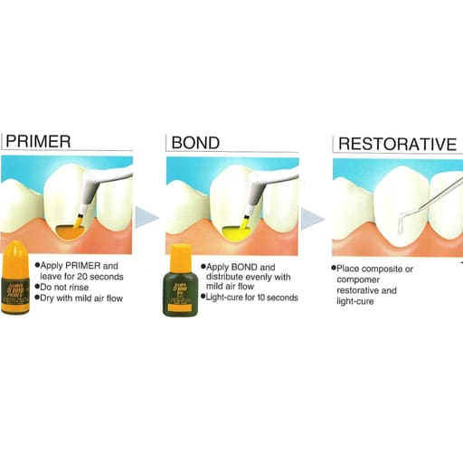 Kuraray Clearfil SE Bond Introductory Kit