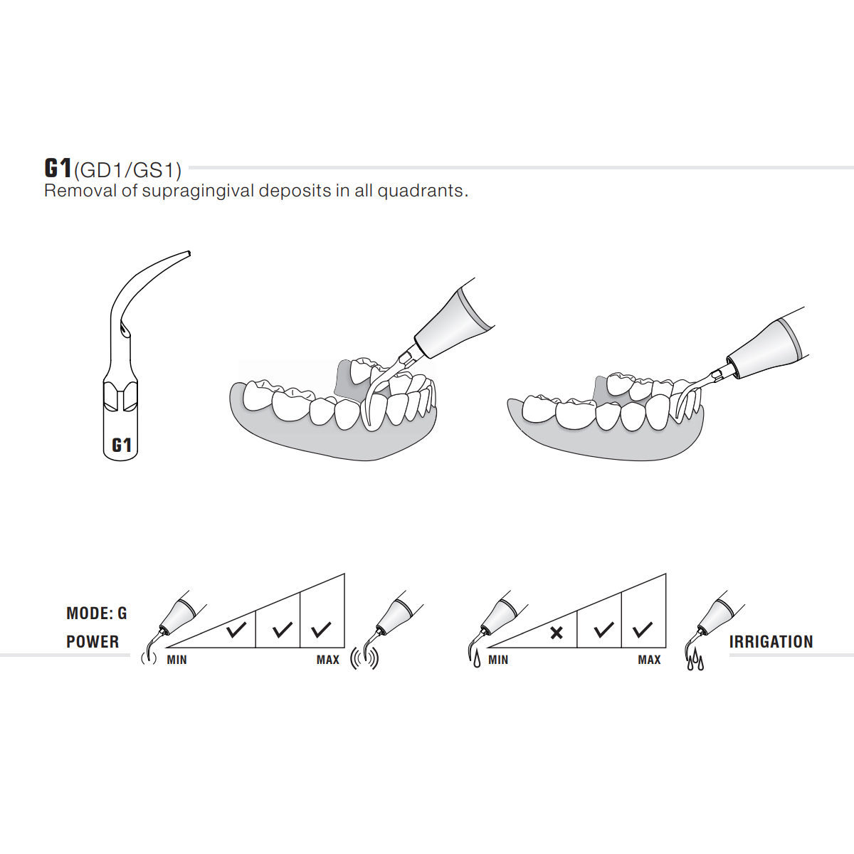 Woodpecker Scaler Tip G1 for UDS & EMS Scalers