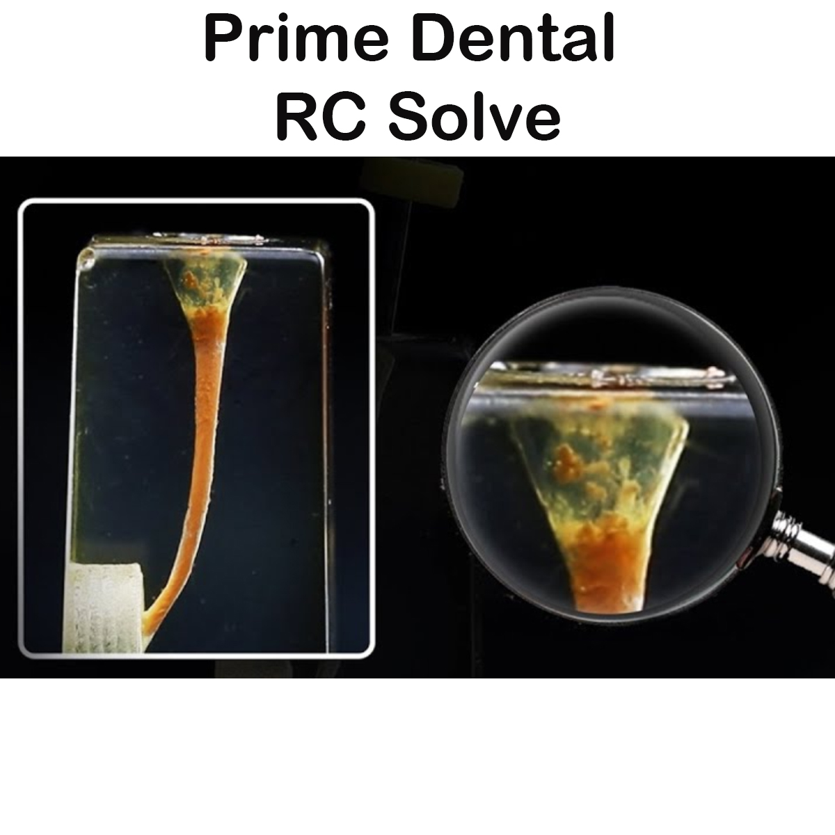 Prime Dental RC Solve 15ml