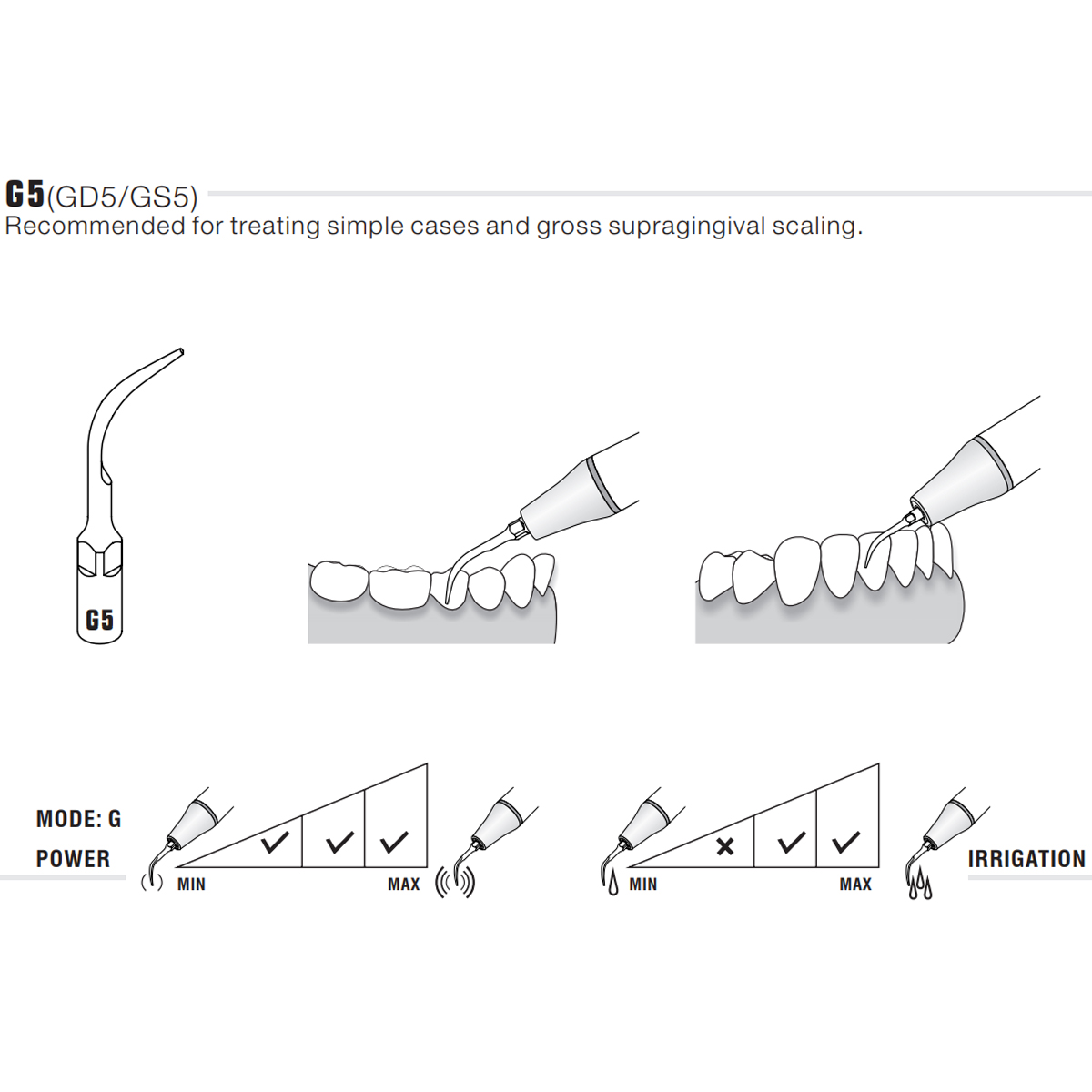 Woodpecker Scaler Tip G5 for UDS & EMS Scalers 