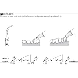 Woodpecker Scaler Tip G5 for UDS & EMS Scalers  - 5