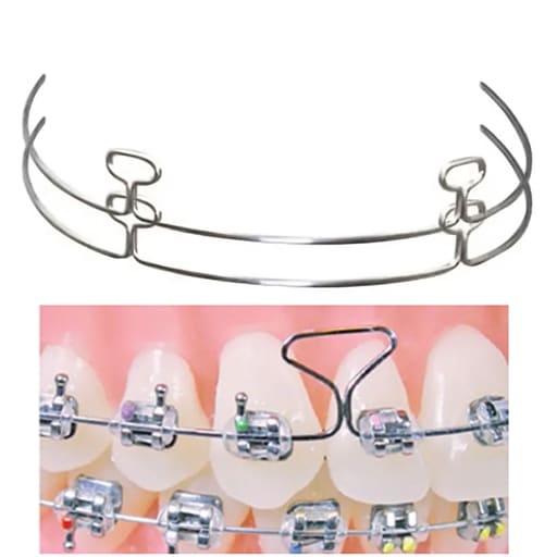 OSL Stainless Steel T-Loop Archwires (Pack Of 10)