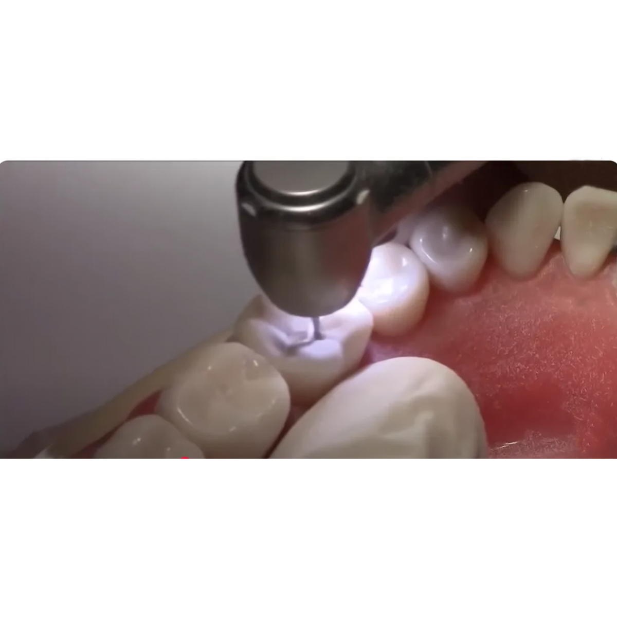 NSK S-Max M900L Airotor Handpiece