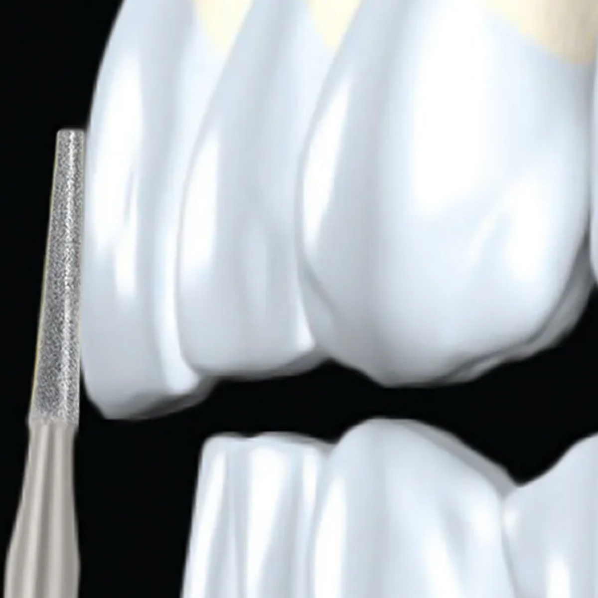 Pivo Taper Flat End Contra-angle Diamond Burs CA - TF (Pack Of 5)