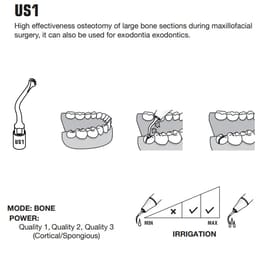 Woodpecker Piezo Bone Surgery Tip - US1 - 3