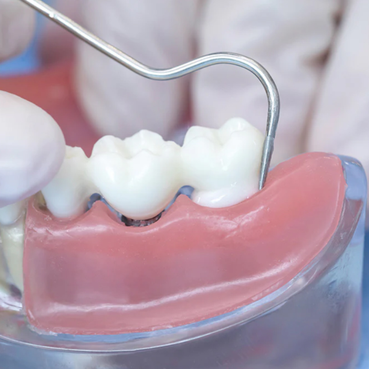 Voco Meron Set & liquid