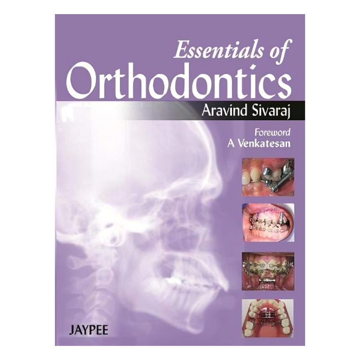 Jaypee Medical Essentials Of Orthodontics (ISBN - 903292)