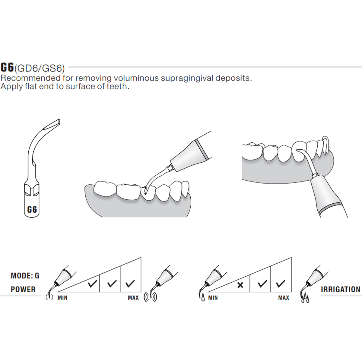 Woodpecker Scaler Tip G6 for UDS & EMS Scalers