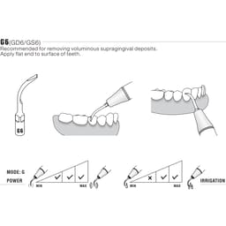 Woodpecker Scaler Tip G6 for UDS & EMS Scalers - 5