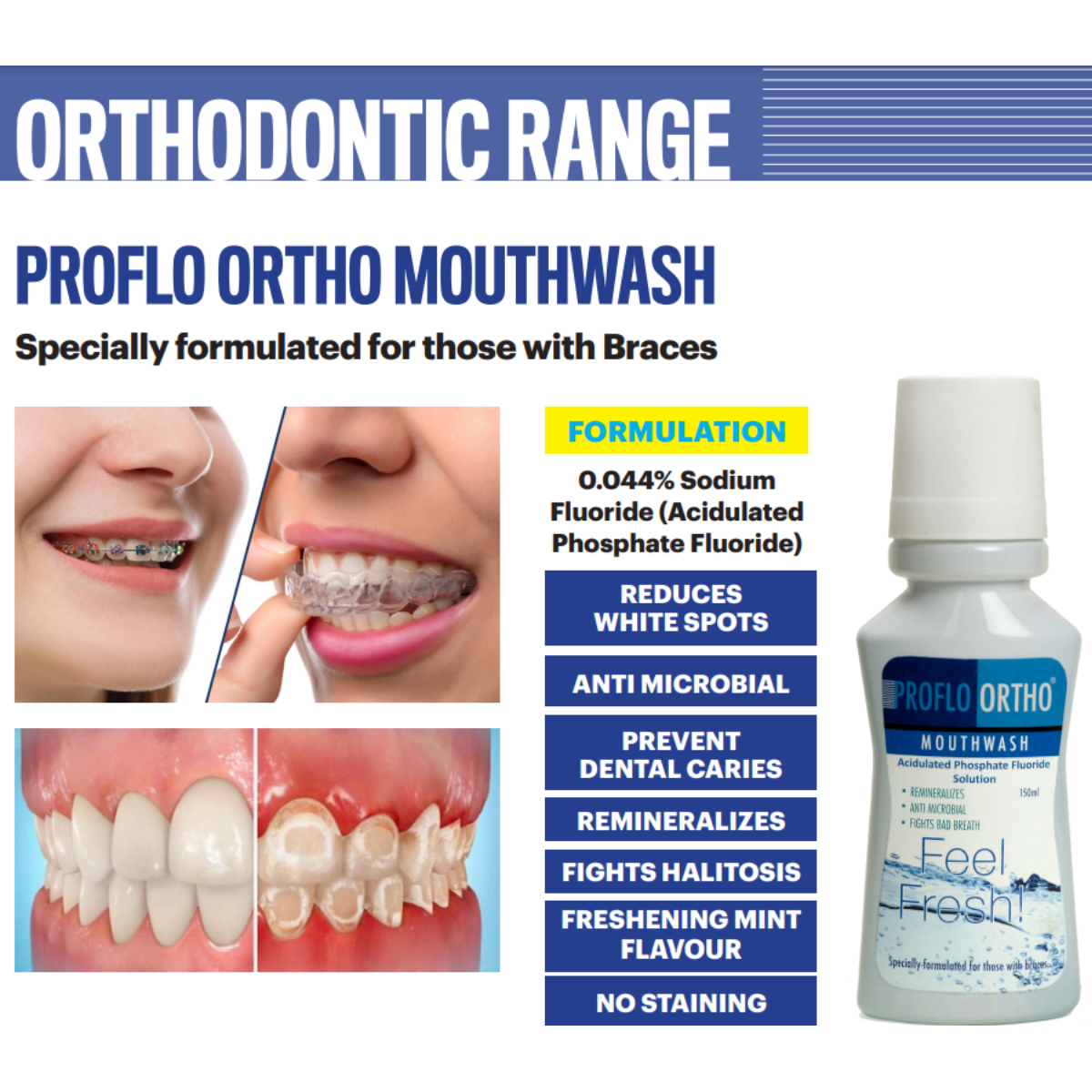 Sandika Pharma Proflo Ortho Acidulated Mouthwash (Pack of 12)