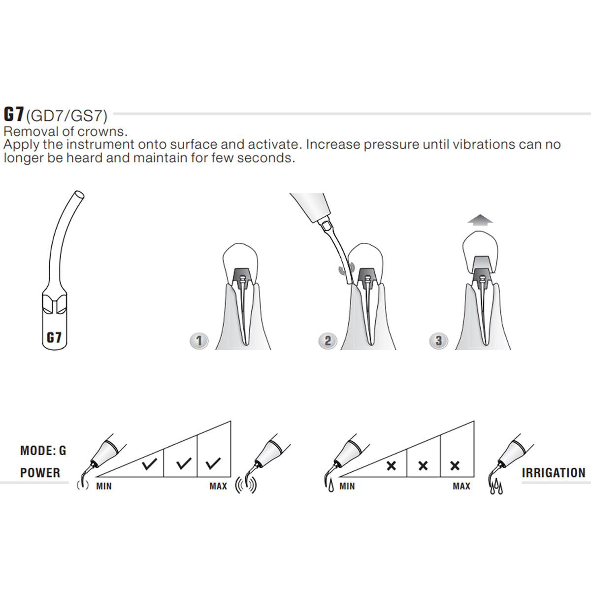 Woodpecker Scaler Tip G7 for UDS & EMS Scalers