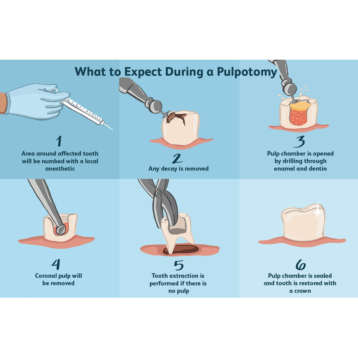 DPI MTA Mineral Trioxide Aggregate Reparative Cement
