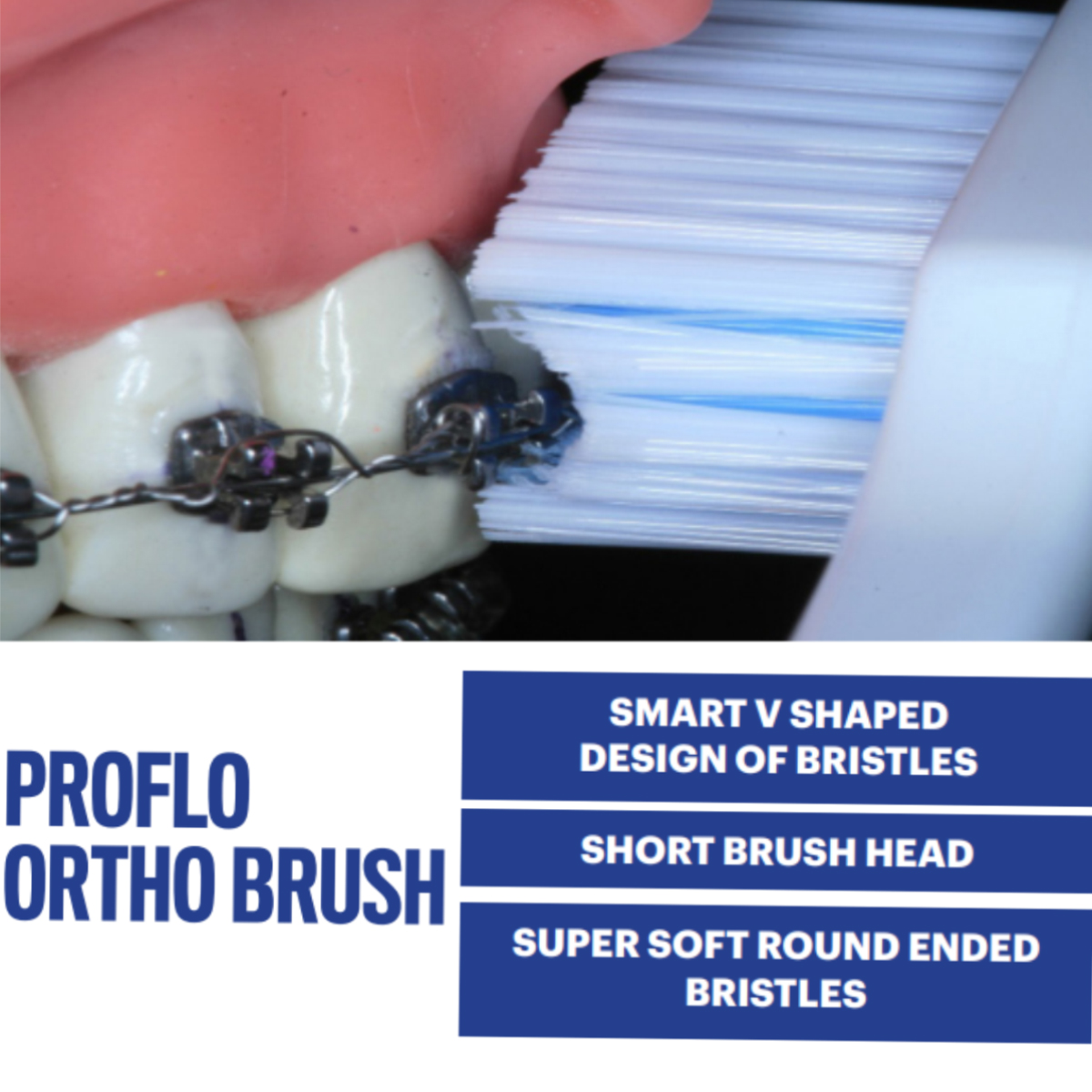 Sandika Pharma Proflo Ortho Brush (Pack of 12)